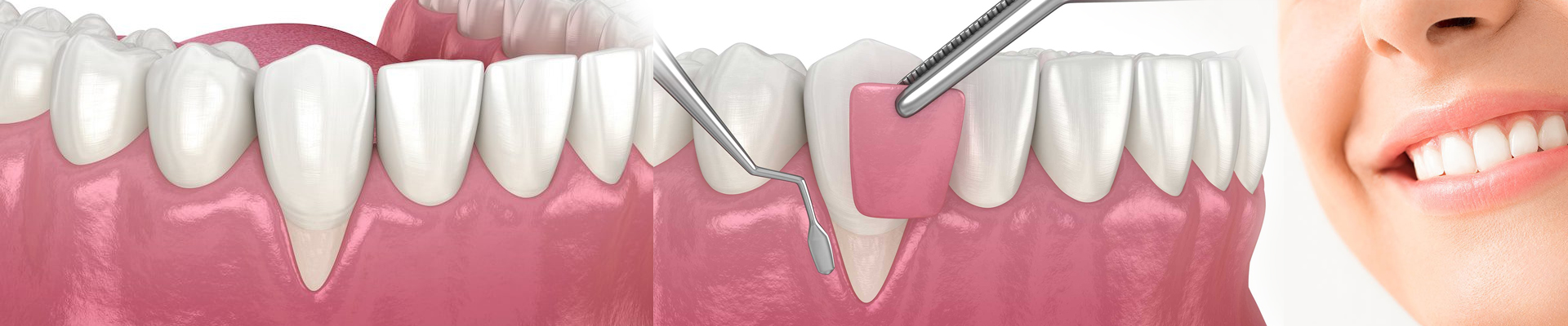 Dental surgery