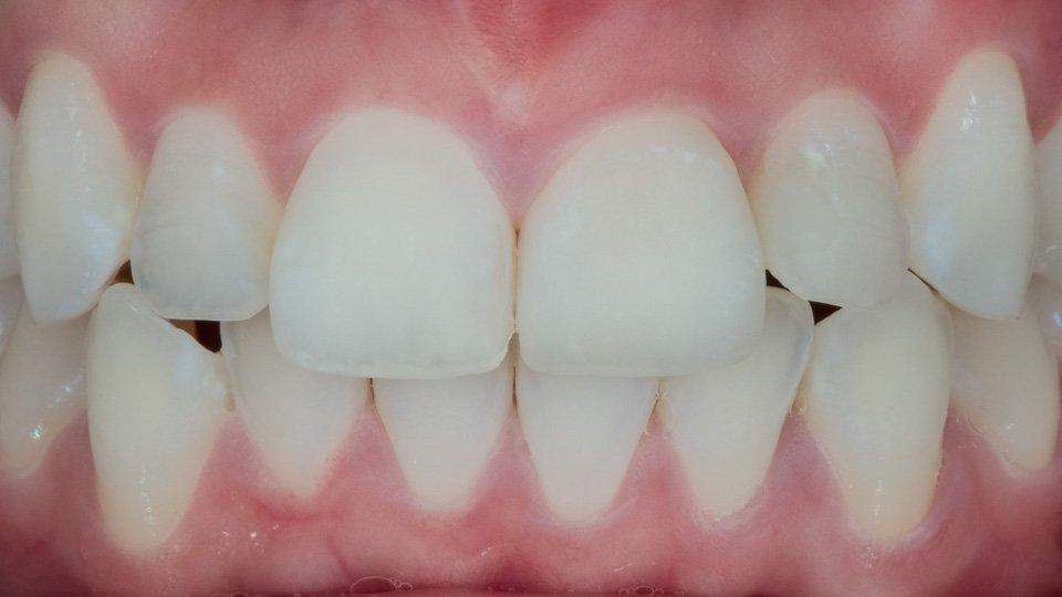 Healthy gums