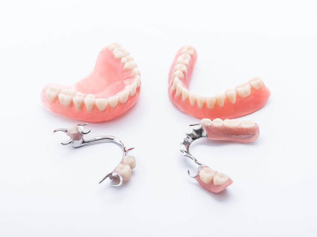 Metal Frame Dentures