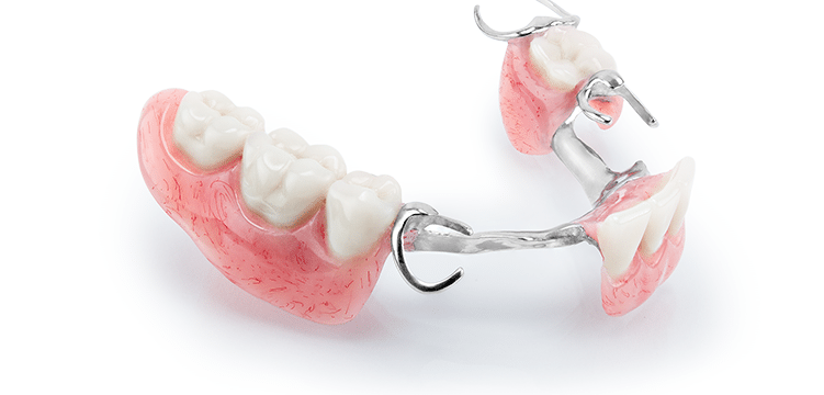 Partial Denture
